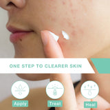 Clarifast One-Step Acne Treatment